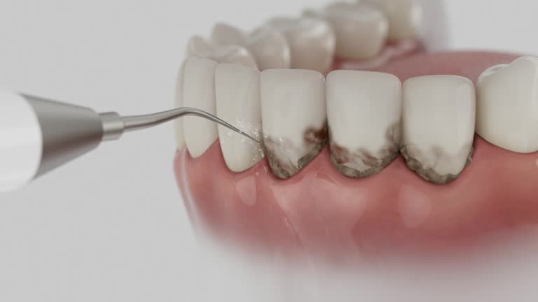Reliable Dental Implants contractor in Lavon, TX by Smile Center Dentistry